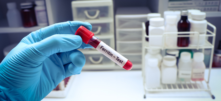 Normal Ferritin Levels by Age: Full Chart for Men & Women