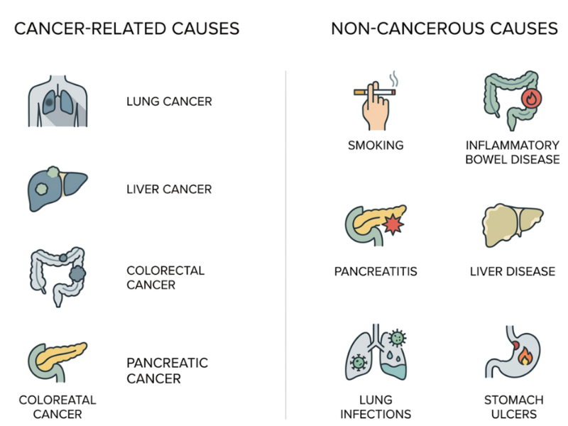 High CEA Doesn't Always Mean Cancer