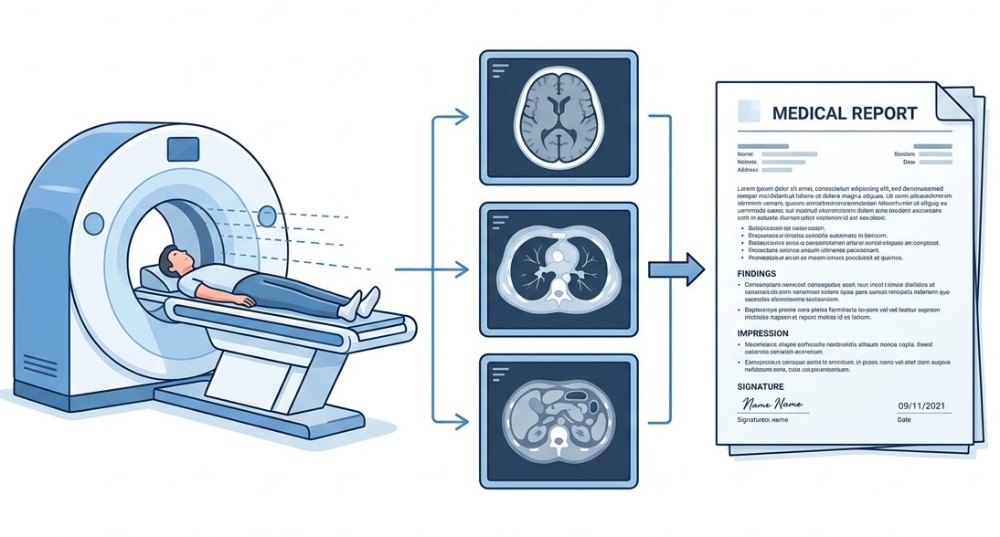 CT scan report